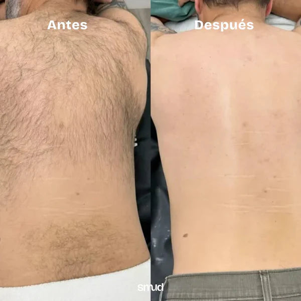 Piedra Mágica Borrador De Vello Exfoliante | Crema Hidratante de Regalo