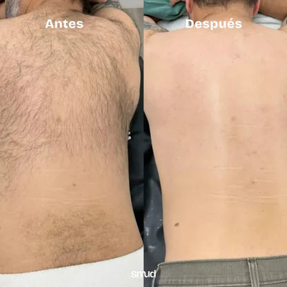 Piedra Mágica Borrador De Vello Exfoliante | Crema Hidratante de Regalo